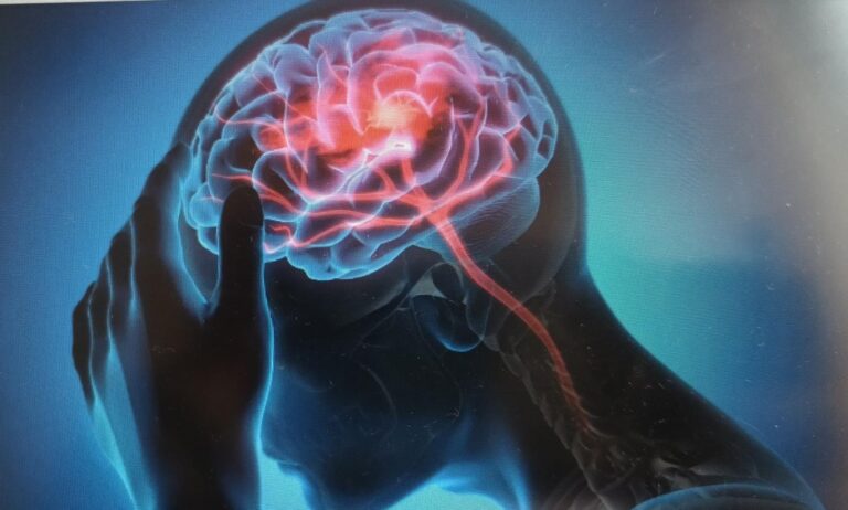 Care sunt principalele semne că ești în pericol să suferi un accident vascular cerebral