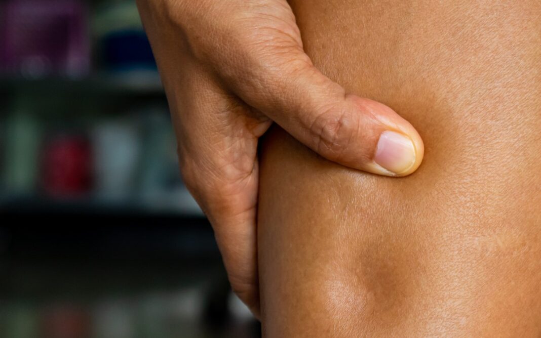 Cum scăpăm de retenţia de apă din organism. Efectul ceaiului de păpădie