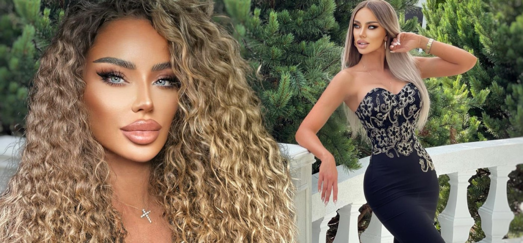 Bianca Drăgușanu, de nerecunoscut după o operație estetică. Cum arată vedeta VIDEO