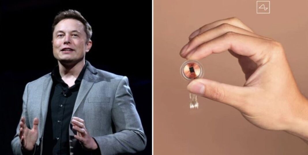 De ce ar trebui să fim sceptici față de afirmațiile lui Elon Musk despre primul implant Neuralink