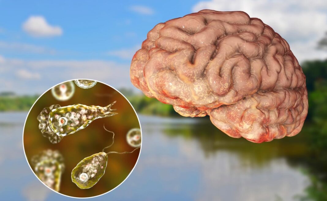 Amiba devoratoare de creier care poate fi prezentă în apa de la robinet. Omoară până la 99 % dintre persoanele infectate