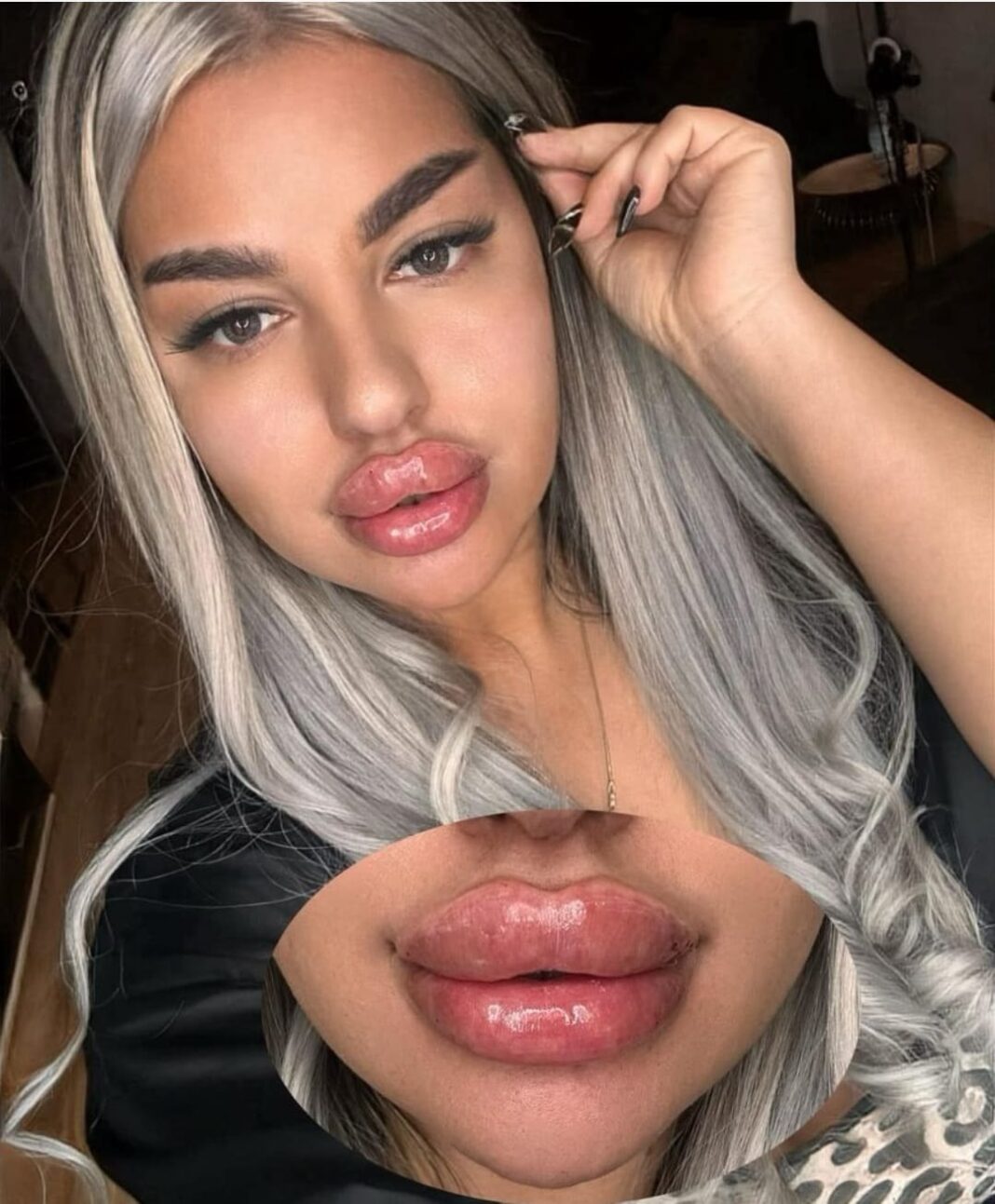 Clinică ilegală de estetică medicală din București, închisă de autorități. Cine făcea intervențiile chirurgicale FOTO