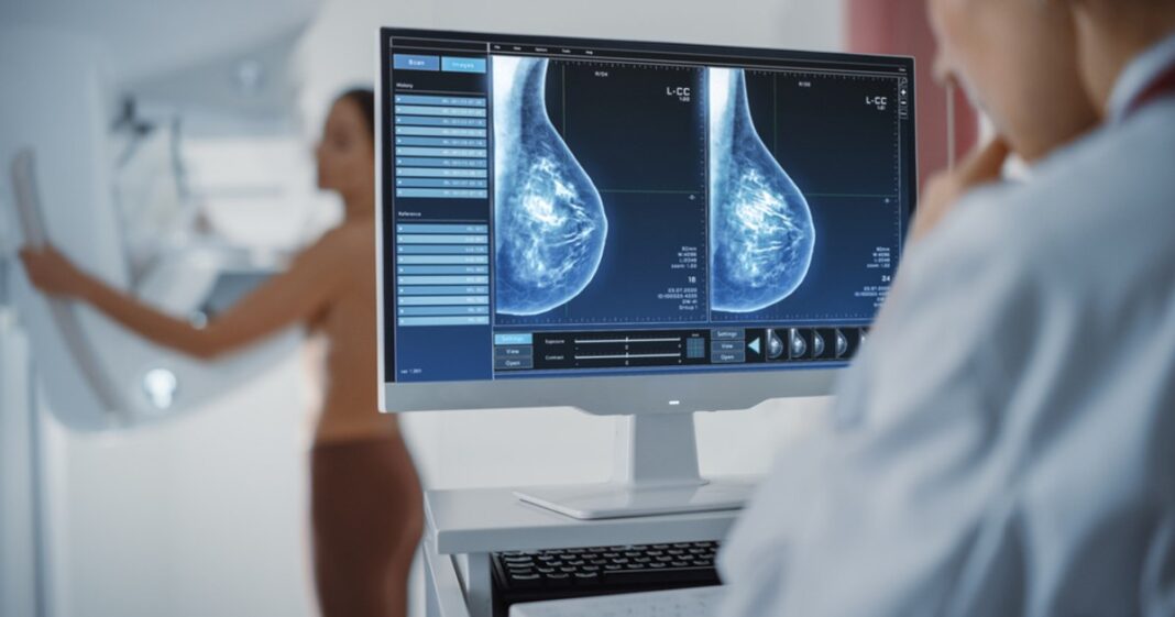 Specialiștii au aprobat un medicament care încetinește evoluția cancerului mamar. „Nu mă mai privesc ca pe o persoană pe moarte”
